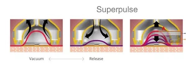 [/userfiles/files/SuperPulse1a.jpg]